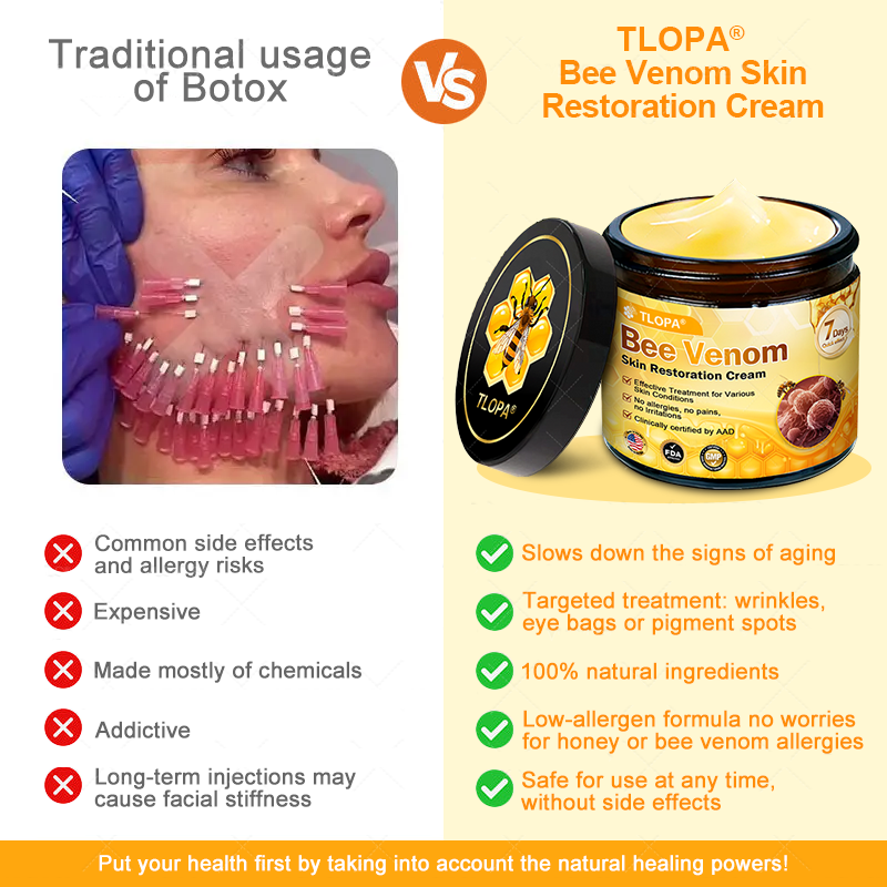 30%-skin✅ 𝐀𝐖𝐙𝐋𝐎𝐕𝐄® Bee venom Comprehensive  Cream 🔥