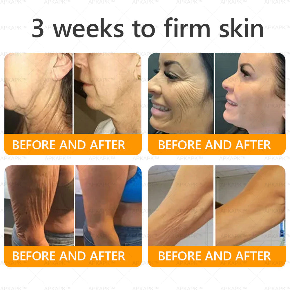 🔥 LAST DAY 80% OFF  🇬🇧𝐀𝐖𝐙𝐋𝐎𝐕𝐄® Bee venom Comprehensive Cream  ✅Made and Shipped from the UK ✅