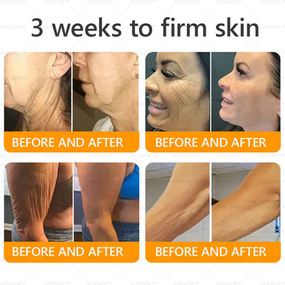 🔥 LAST DAY 80% OFF  🇬🇧𝐀𝐖𝐙𝐋𝐎𝐕𝐄® Bee venom Comprehensive Cream  ✅Made and Shipped from the UK ✅