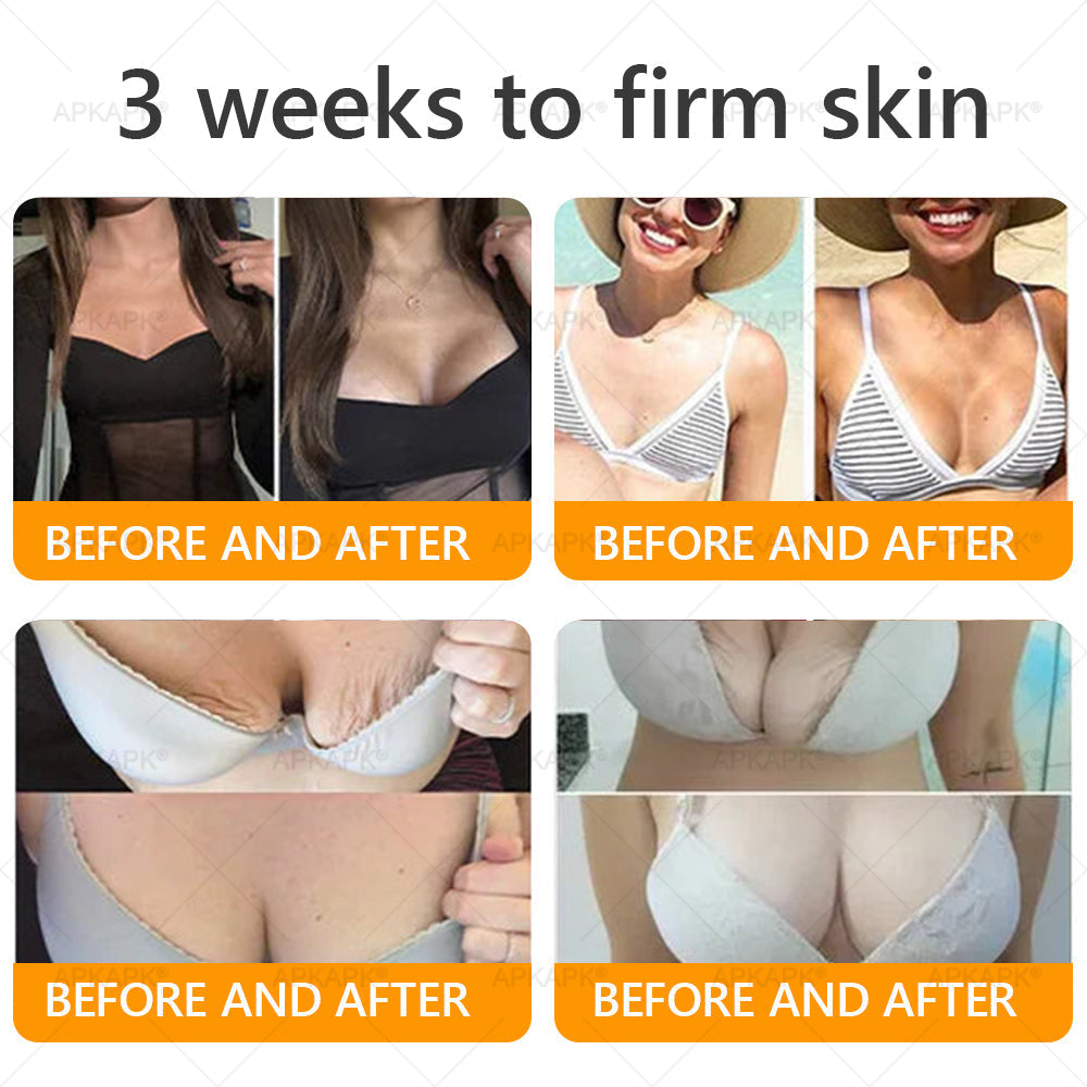 🐝✨ APKAPK® Bee venom Comprehensive Cream 🔥 Sagging Skin, Fine Lines, Loss of Firmness, Flat Bust, Drooping Hips, and More