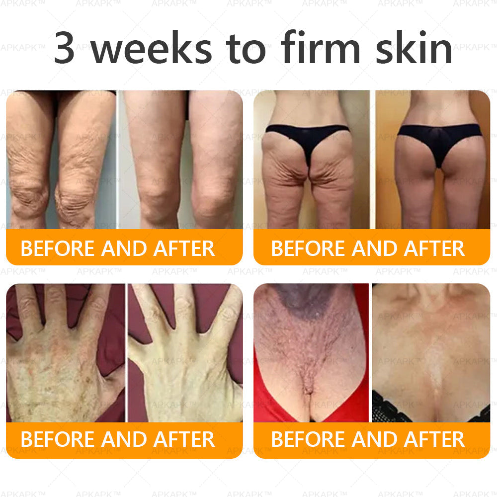 🔥 LAST DAY 80% OFF  🇬🇧𝐀𝐖𝐙𝐋𝐎𝐕𝐄® Bee venom Comprehensive Cream  ✅Made and Shipped from the UK ✅