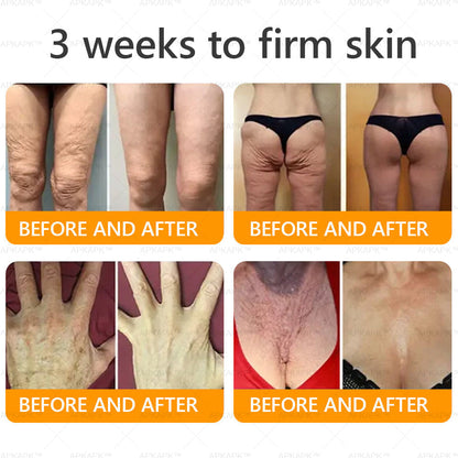 🔥 LAST DAY 80% OFF  🇬🇧𝐀𝐖𝐙𝐋𝐎𝐕𝐄® Bee venom Comprehensive Cream  ✅Made and Shipped from the UK ✅